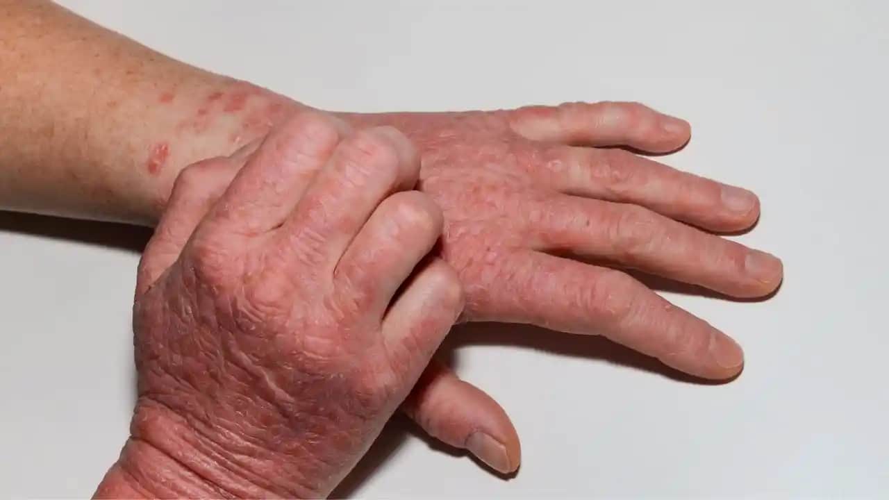 Cilt İrritasyonu ve Korunma Yolları: Kozmetik Bakımında Bilinçli Yaklaşımlar