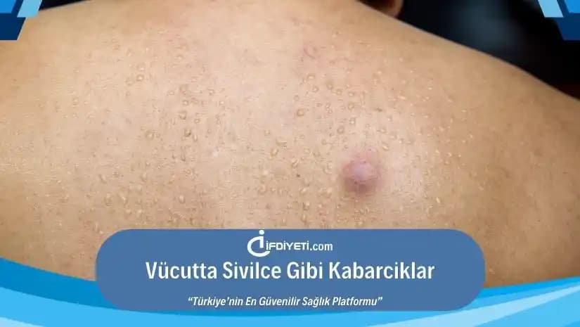 Cilt Kabarcıkları Nedenleri ve Doğal Çözüm Yöntemleri Hakkında Kapsamlı Rehber