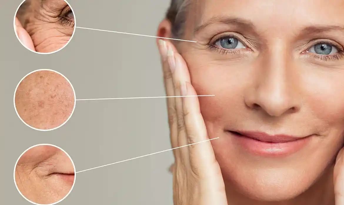 Cilt Kırışıklıkları ve Gençlik Sırları: Etkili Bakım ve Tedavi Yöntemleri