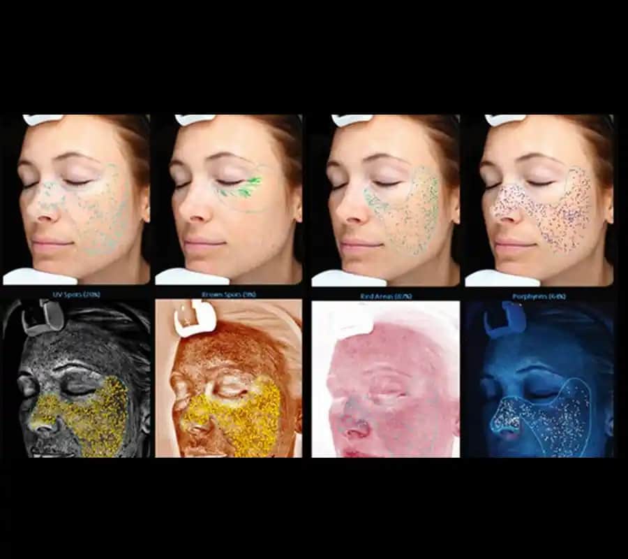 Cilt Renk Analiziyle Güzellik ve Bakımda Doğru Adımların Önemi ve Modern Teknolojiler