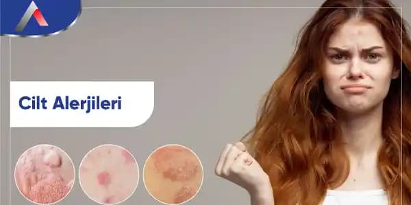 Cilt Yaralarının Çeşitleri ve Özellikleri: Güzellik ve Sağlık İçin Bilinmesi Gerekenler