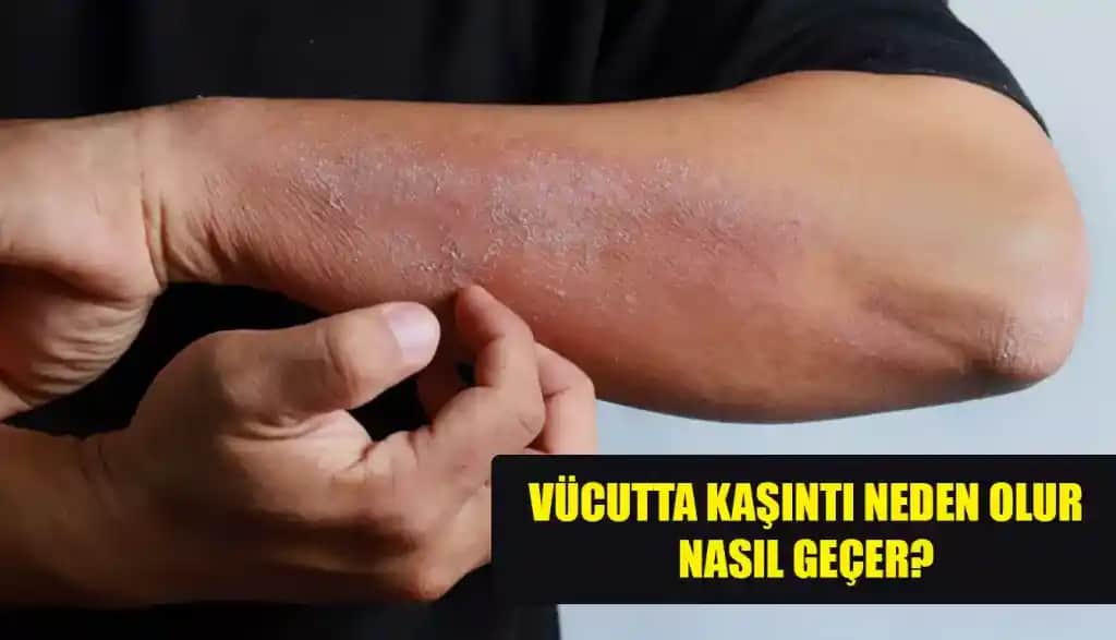 Ciltte Alerji Çeşitleri ve Korunma Yöntemleri Hakkında Kapsamlı Rehber