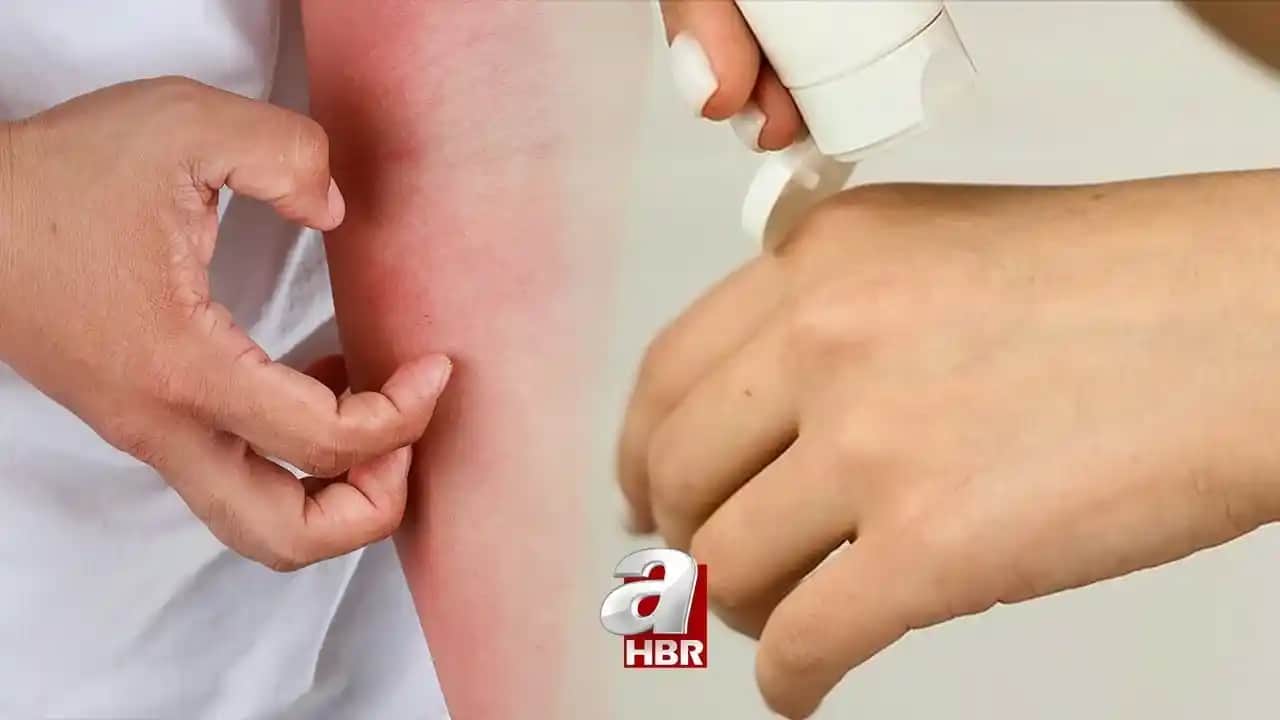 Ciltte Geçmeyen Kızarıklığın Nedenleri ve Etkili Tedavi Yöntemleri