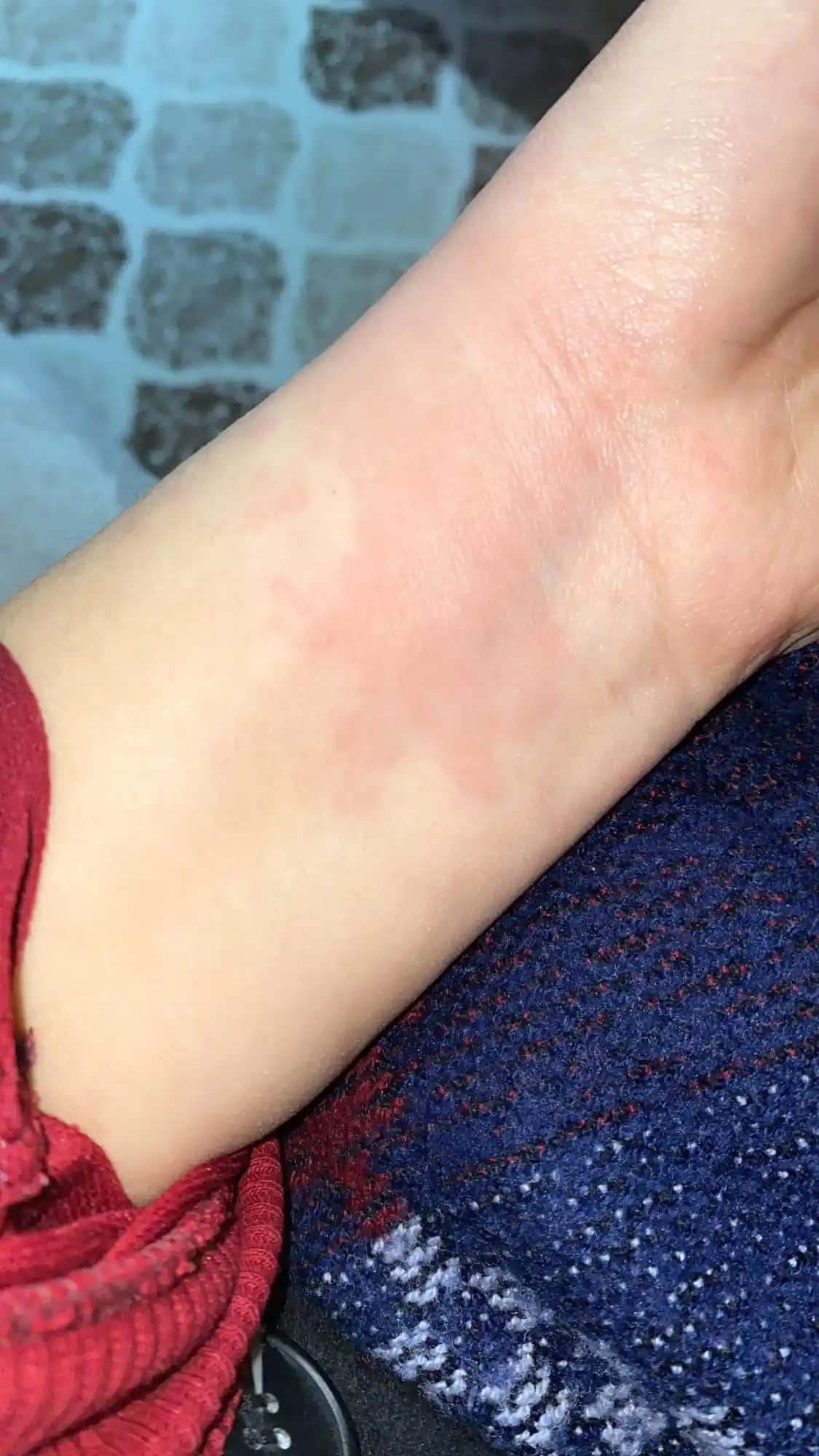 Ciltte Kaşıntı ve Yara Sorunlarına Güncel Kozmetik ve Sağlık Yaklaşımları