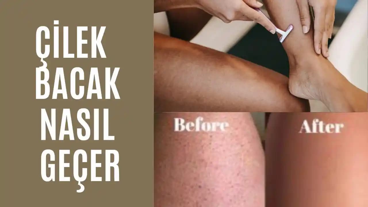 Ciltteki İzlerin Giderilmesi İçin Etkili ve Güvenilir Kozmetik Çözümler