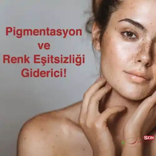 Ciltteki Kararmaların Nedenleri ve Etkili Çözüm Yöntemleri Hakkında Kapsamlı Bilgi