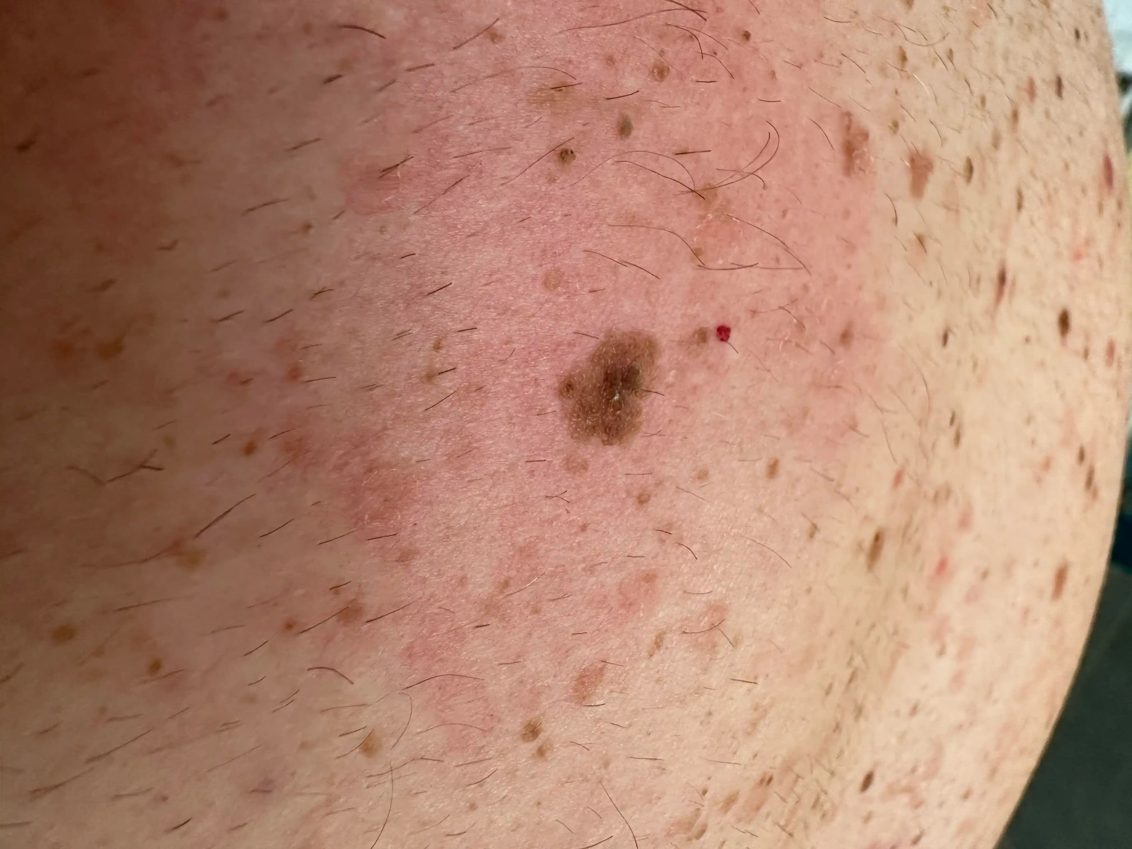 Ciltteki Lekeler ve Güzellik Sırları: Etkili Çözüm Yolları ve Profesyonel Tavsiyeler