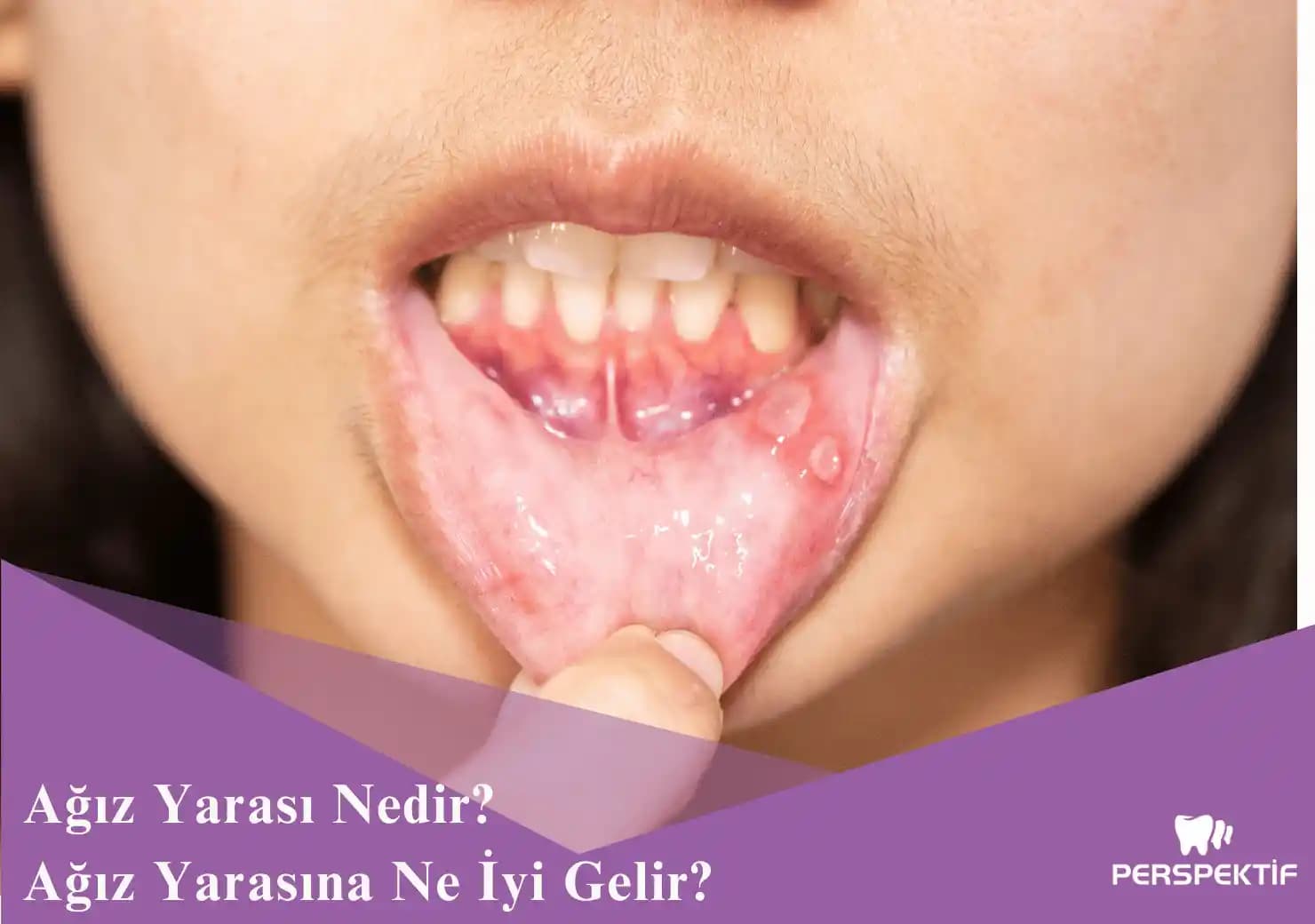 Çizik Yaralarına Doğal ve Güvenli Çözüm Rehberi: Hızlı İyileşme İçin Tavsiyeler