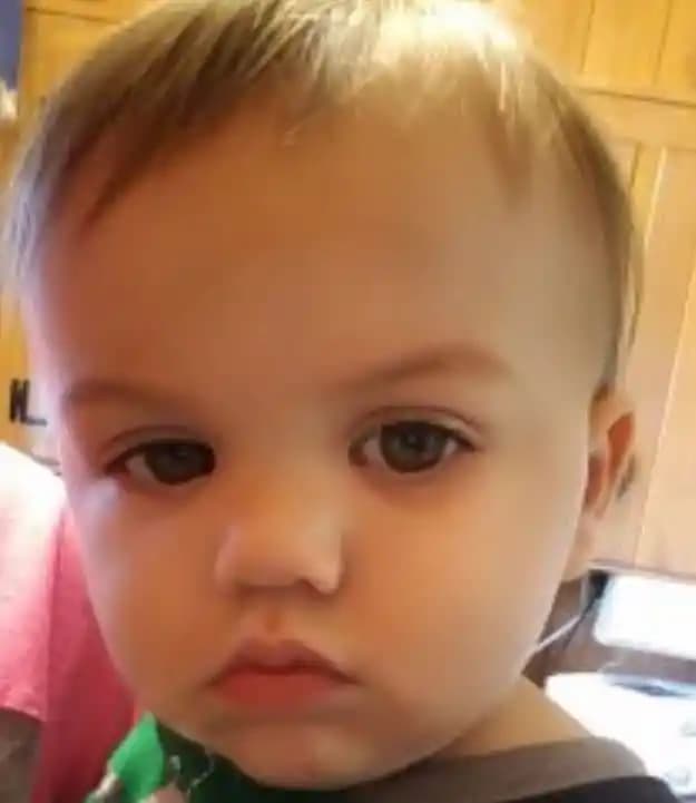 Çocuklarda Göz Altı Morluklarının Nedenleri ve Etkili Çözüm Yolları