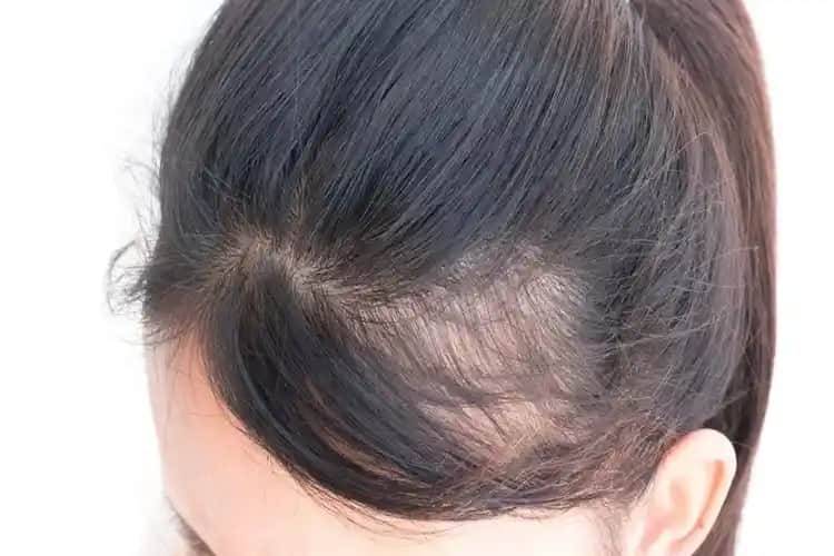 Deniz Suyu Saç Uzamasını Hızlandırır mı Gerçekler ve Doğru Bakım İpuçları