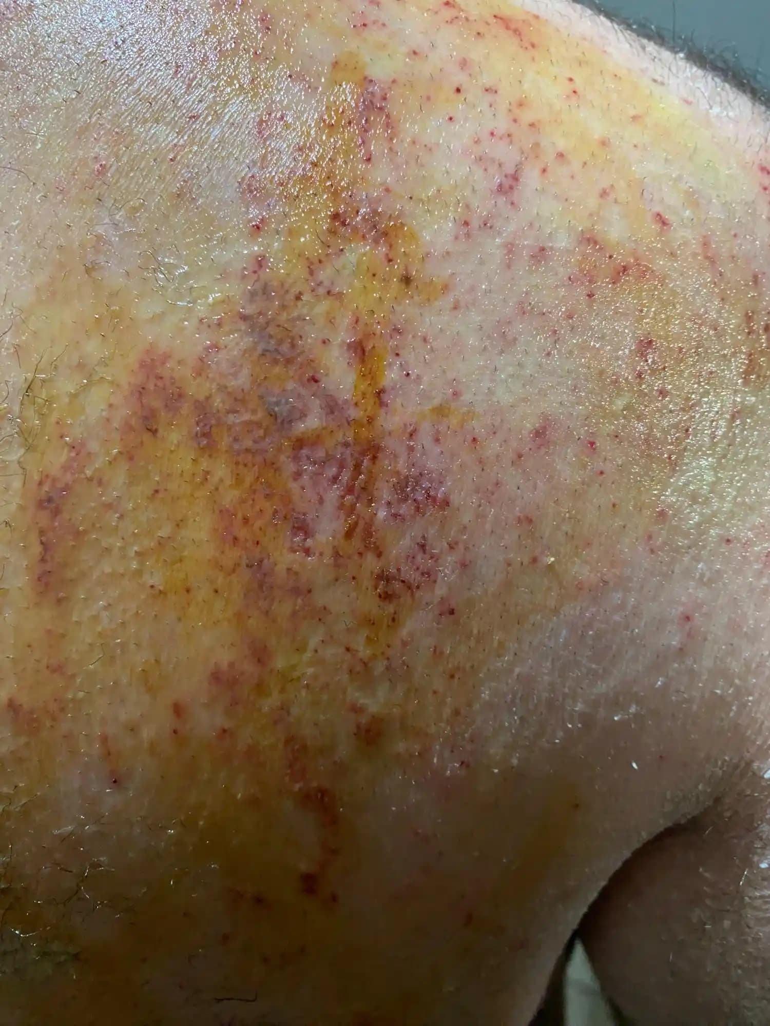 Deri Tahrişi ve Kozmetik Ürünler: Bilinçli Kullanımın Önemi ve Korunma Yolları