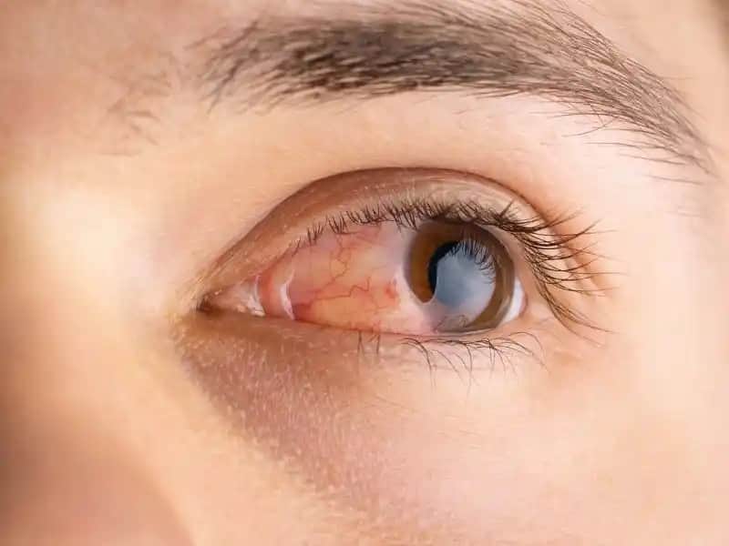 Deri Tahrişini Önleyen Kozmetik Yaklaşımlar ve Etkili Cilt Bakımı Yöntemleri