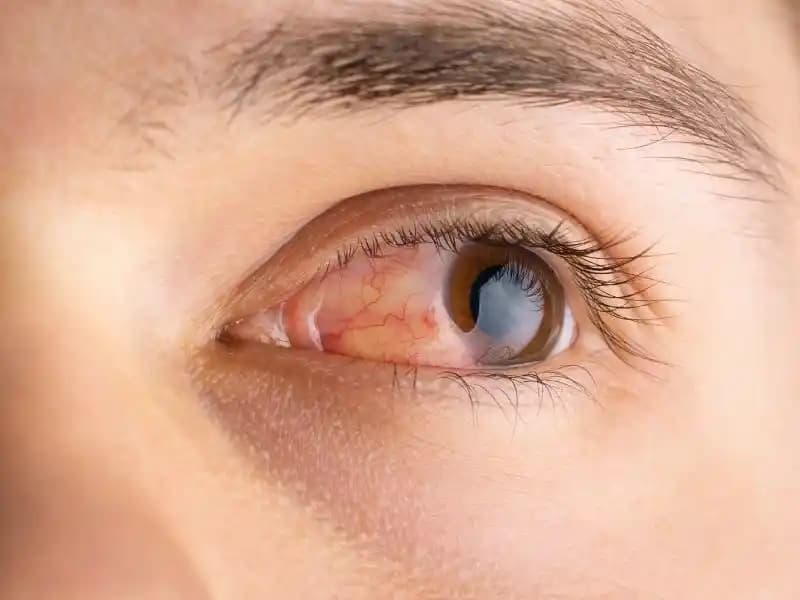 Deri Tahrişini Önleyen Kozmetik Yaklaşımlar ve Etkili Cilt Bakımı Yöntemleri