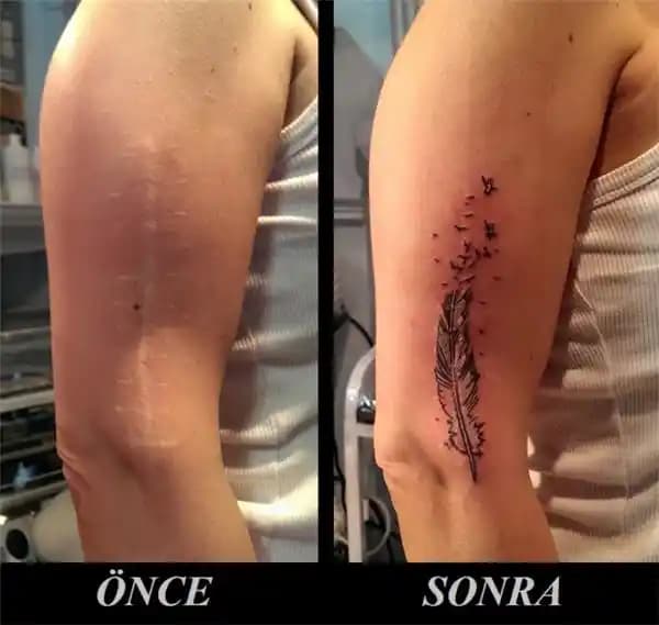 Dikiş İzi Sorununa Çözüm Yolları: Estetik ve Kendine Güven İçin Rehber