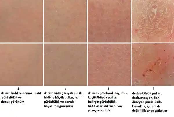 Dikiş Kaşıntısı ve Kozmetik Uygulamalarında Cilt Sağlığına Dikkat Edilmesi Gerekenler