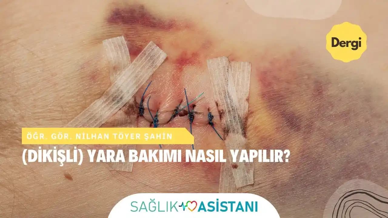 Dikiş Tutmayan Yaraların Nedenleri ve Etkili Tedavi Yöntemleri