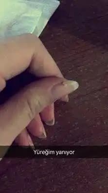 Dipten Kırılan Tırnaklar: Nedenleri, Korunma Yolları ve Etkili Tedavi Yöntemleri