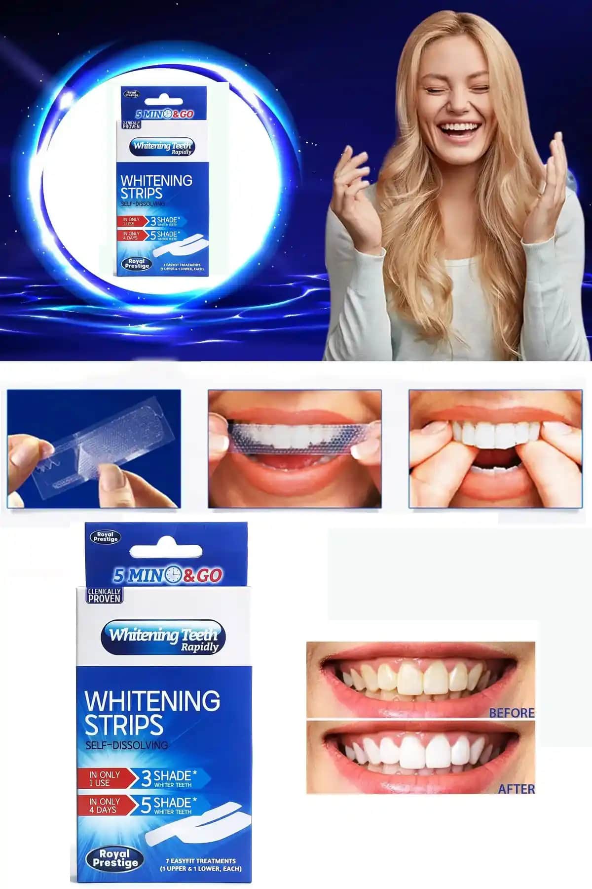 Diş Bandı Nedir ve Estetik Gülüş İçin Nasıl Kullanılır