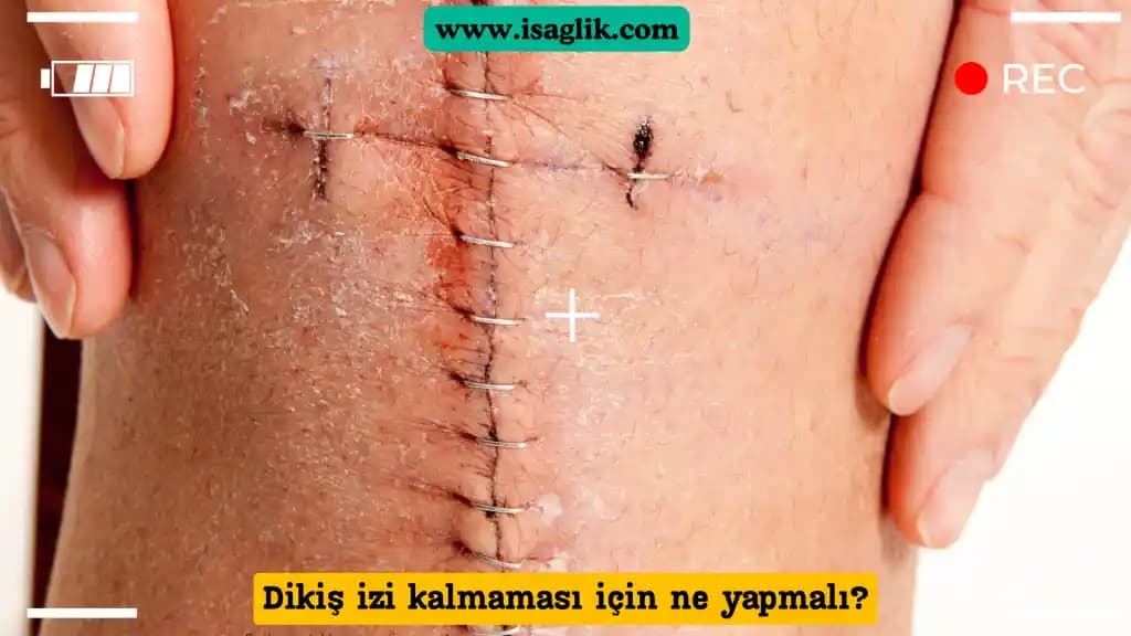 Diş İzleri ve Kozmetikteki Yeri: Estetik ve Sağlık Açısından Değerlendirme