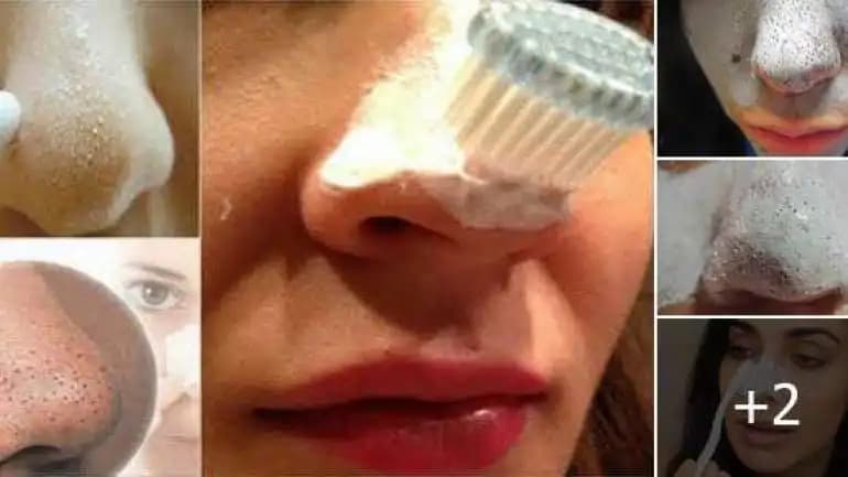 Diş Macunu Siyah Noktası Nedenleri ve Doğal Çözüm Yöntemleri Hakkında Bilgi