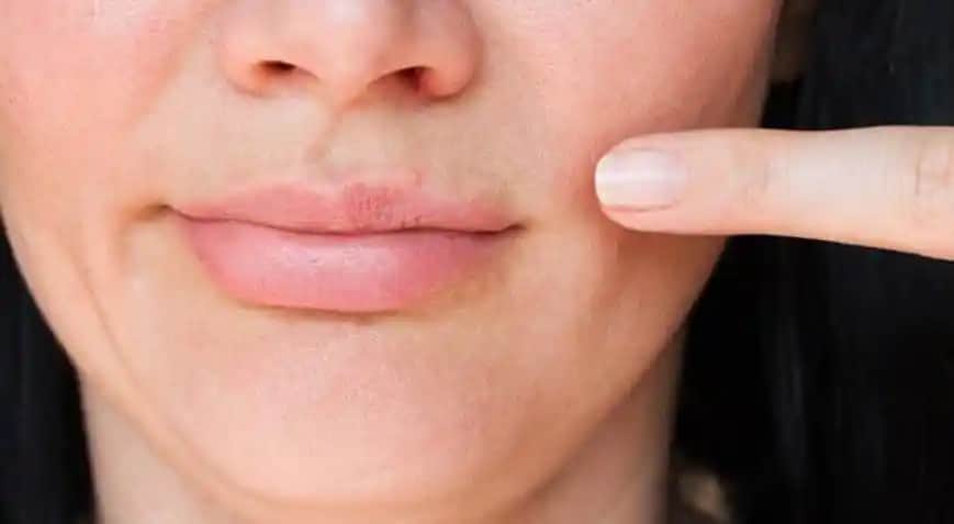 Diş Macunu ve Sivilce İlişkisi: Ciltteki Tahriş ve Alerjik Reaksiyonlar Hakkında Bilmeniz Gerekenler