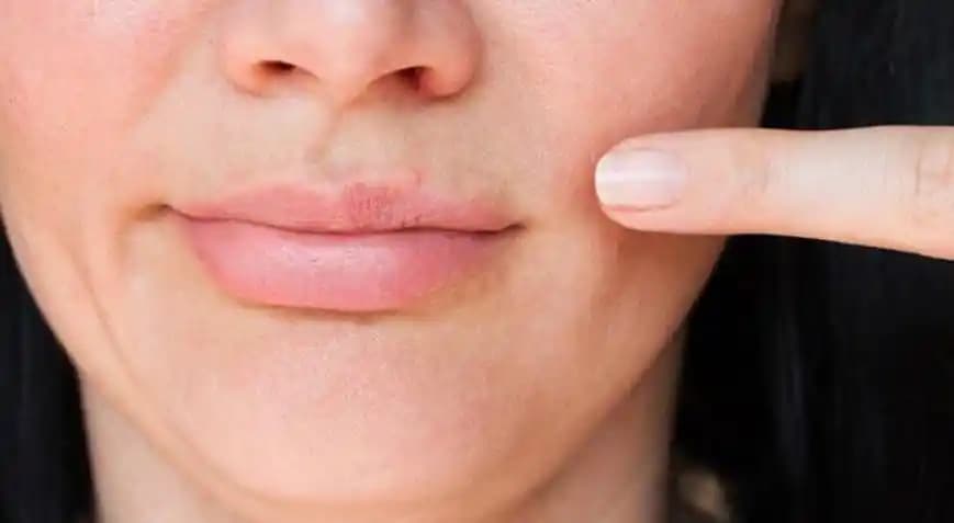 Diş Macunu ve Sivilce İlişkisi: Ciltteki Tahriş ve Alerjik Reaksiyonlar Hakkında Bilmeniz Gerekenler