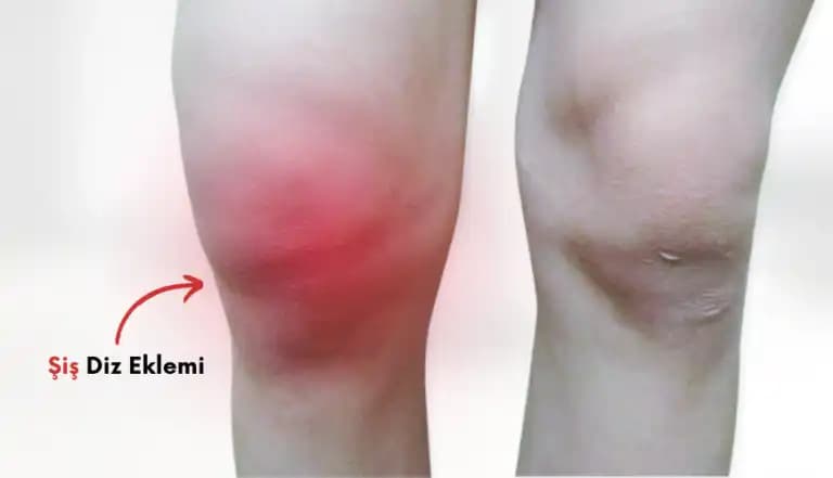 Dizde Kararma Nedenleri ve Etkili Çözüm Yöntemleri Hakkında Kapsamlı Rehber