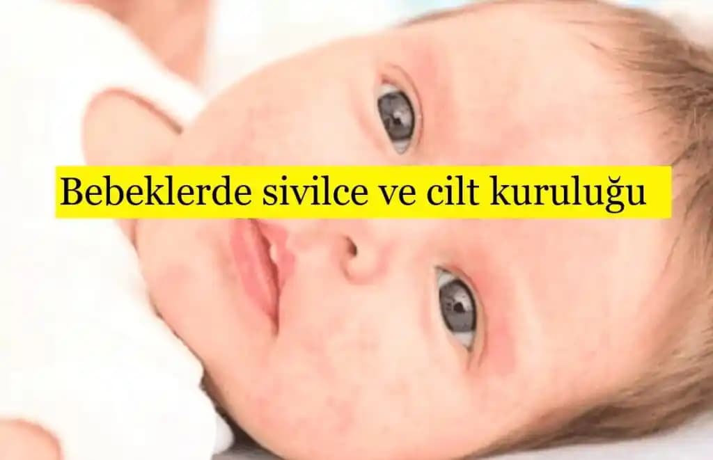 Doğum Sonrası Cilt Kuruluğu Nedenleri Belirtileri ve Etkili Çözüm Yolları