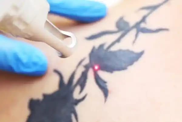 Dövme Jelatini Ne Kadar Süre Kullanılmalı ve Güvenli Uygulama İpuçları