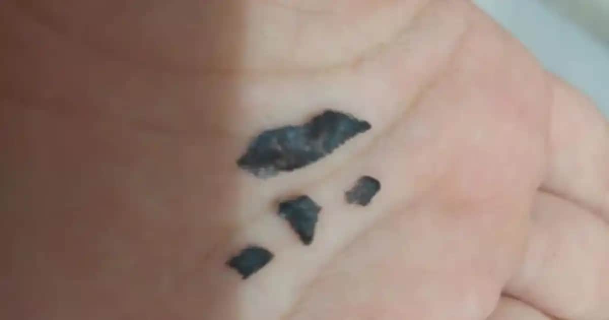 Dövme Kabuk Atma Süresi ve Sağlıklı İyileşme İçin Bilmeniz Gerekenler