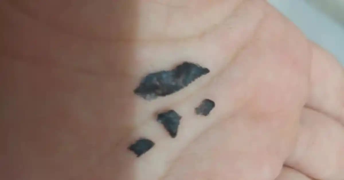 Dövme Kabuk Atma Süresi ve Sağlıklı İyileşme İçin Bilmeniz Gerekenler