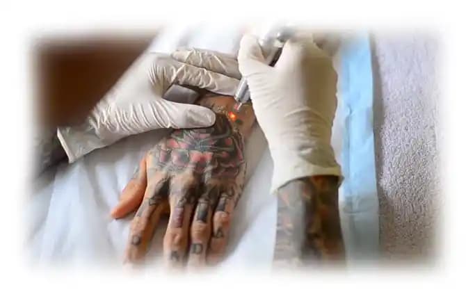 Dövme Yarası ve İyileşme Süreci: Sağlıklı ve Güvenli Dövme Deneyimi İçin Bilmeniz Gerekenler