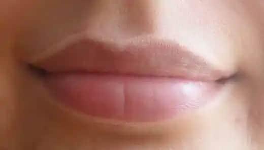 Dudak Kenarı Kızarması Nedenleri ve Etkili Bakım Yöntemleri Hakkında Kapsamlı Bir Rehber