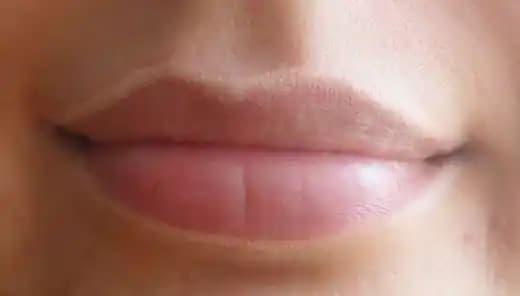 Dudak Kenarı Kızarması Nedenleri ve Etkili Bakım Yöntemleri Hakkında Kapsamlı Bir Rehber