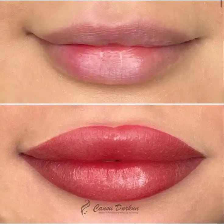 Dudak Modelleri ve Trendler: En Uygun Dudak Şekli Seçim Rehberi