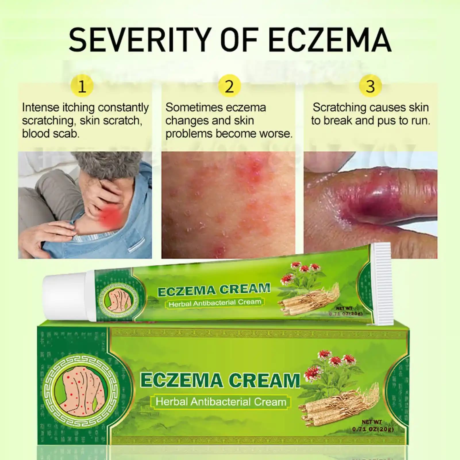 Egzama için Bitkisel Krem Rehberi: Doğal Çözümlerle Sağlıklı Bir Cilt