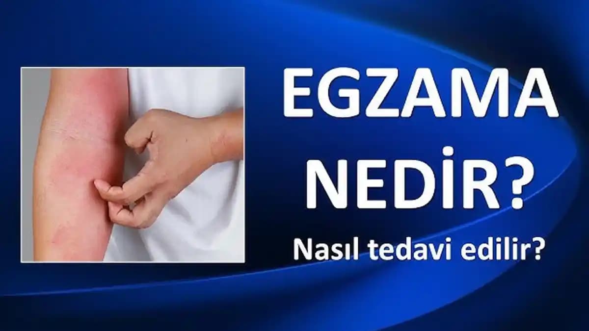 Egzama Kızarıklığı ve Kozmetik Bakım Yöntemleri: Sağlıklı Cilt İçin Bilinmesi Gerekenler