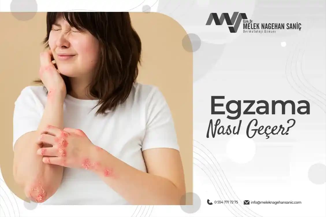 Egzama Lekeleri Nasıl Geçer Cilt Bakımında Etkili Yöntemler ve Tavsiyeler