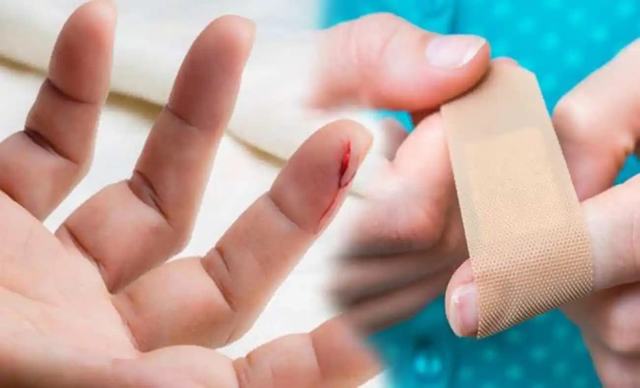 El Kesiğine İyi Gelen Yöntemler ve Cilt Sağlığını Koruma Rehberi