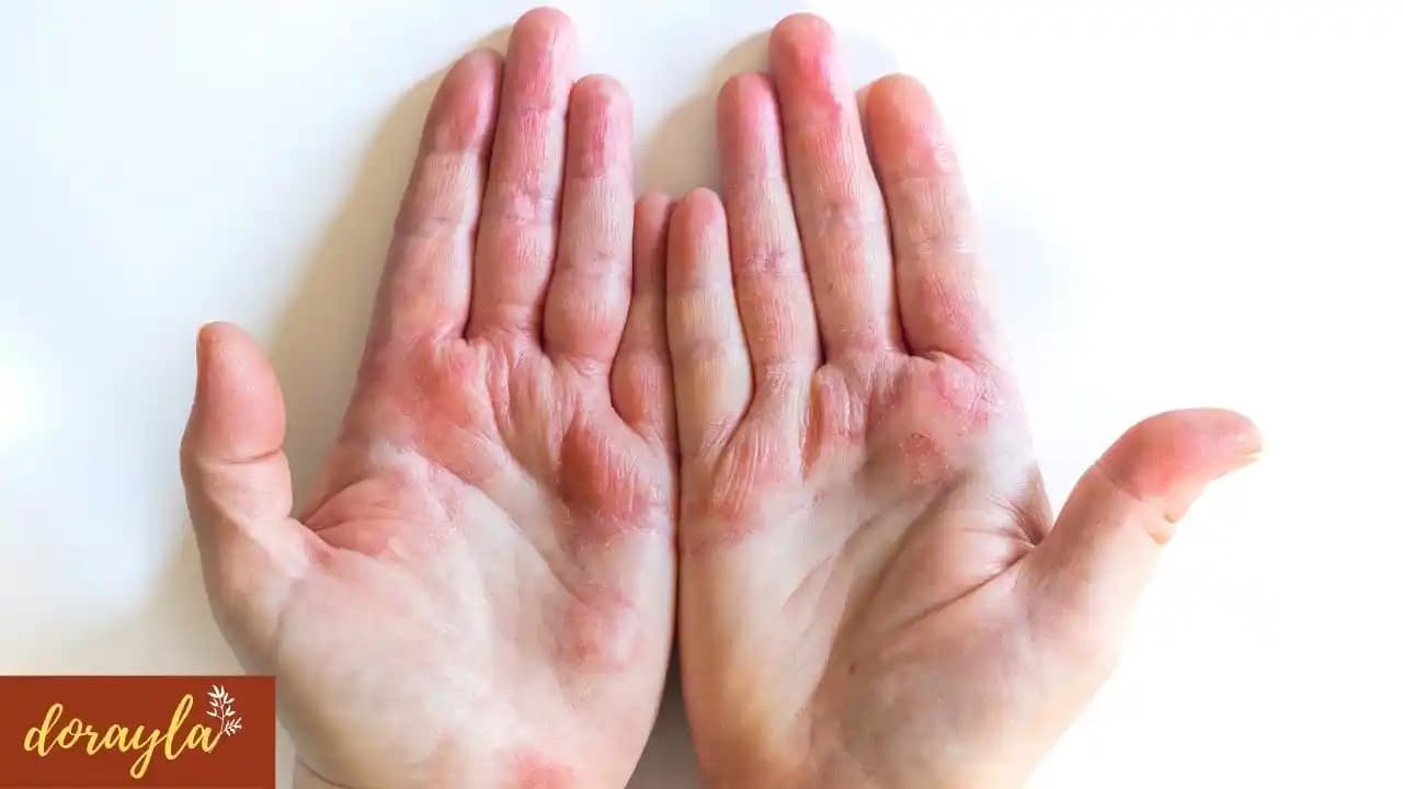 El Yara Bakımında En Etkili Yöntemler ve Kozmetik Ürünler Hakkında Bilgi