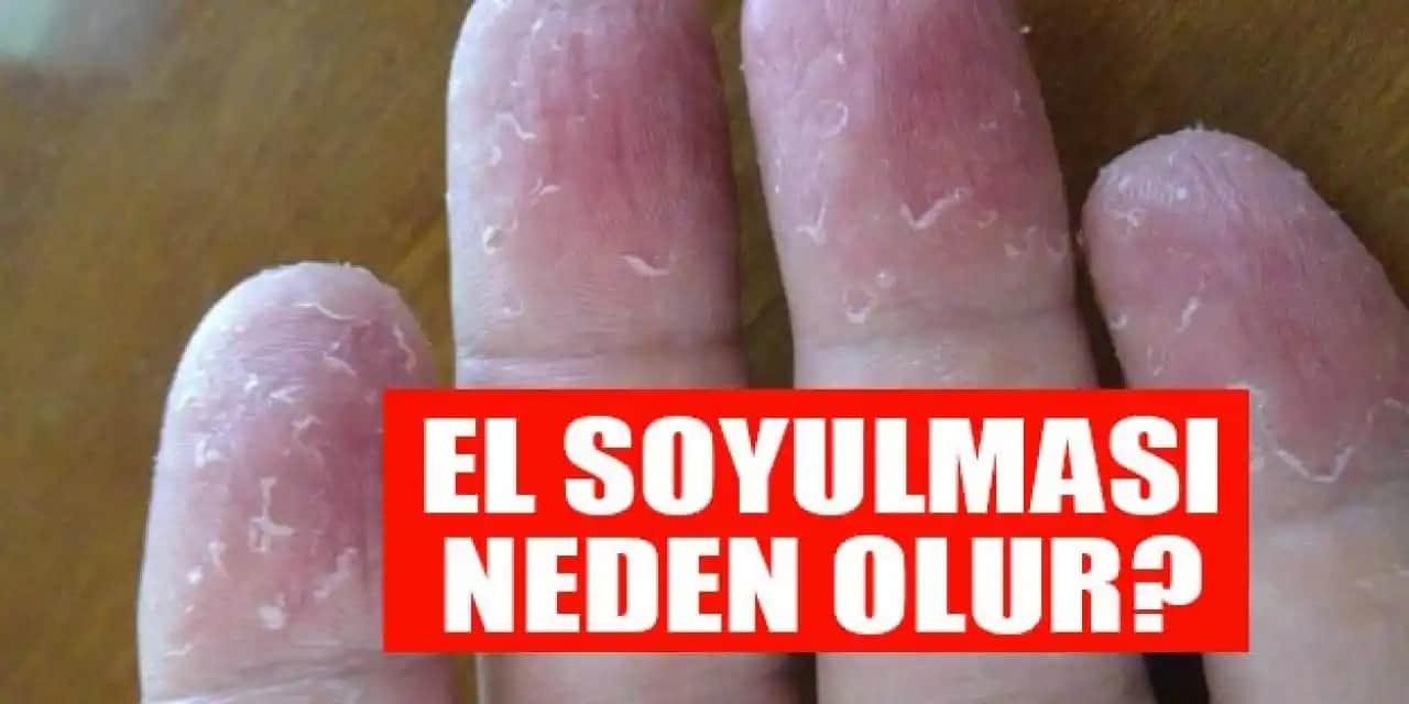 Elde Soyulma Yöntemi: Cilt Sağlığını Destekleyen Modern ve Doğal Temizlik Teknikleri