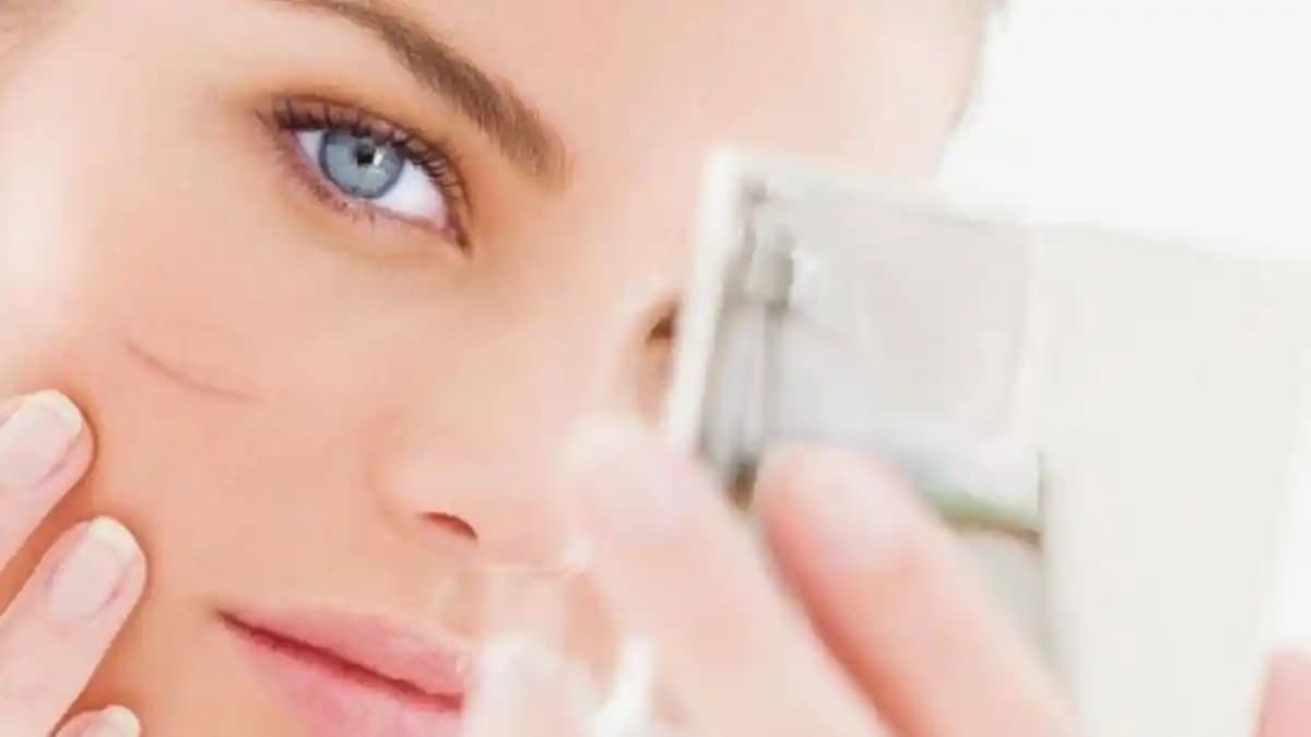 Eski Yara İzleri Nasıl Azaltılır: Klinik ve Doğal Yöntemler Rehberi