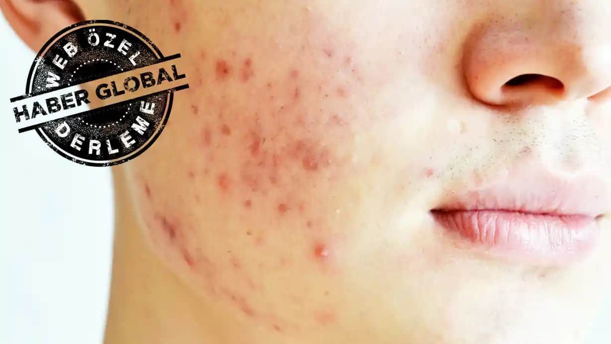 Farklı Cilt Problemlerini Anlamak ve Doğru Çözüm Yollarını Keşfetmek