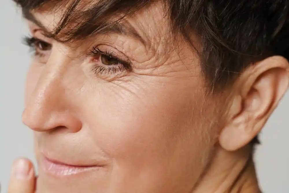 Genç Yaşta Göz Çevresi Kırışıklıkları Neden Olur ve Korunma Yöntemleri
