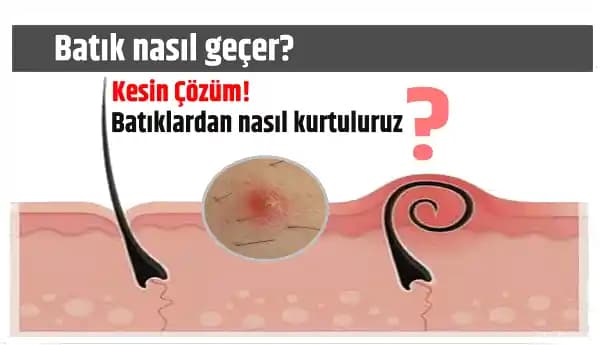 Genital Bölgedeki Batık İzlerinin Giderilmesi ve Cilt Sağlığı İçin Etkili Yöntemler