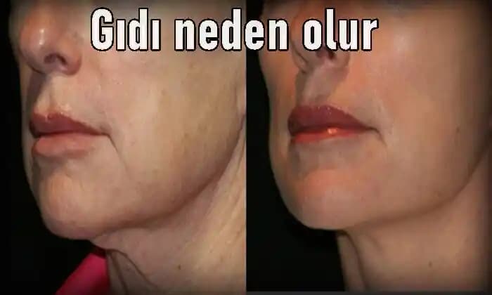 Gıdanın Nedenleri ve Çözüm Yolları: Estetik ve Kendine Güven Üzerine Derin Bir Analiz