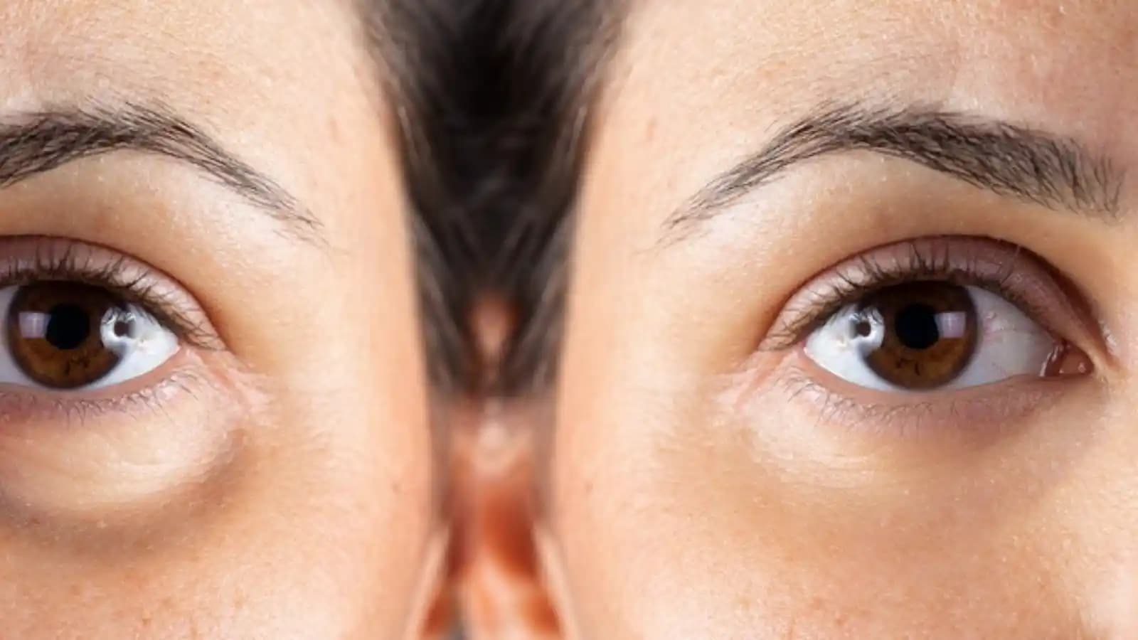 Göz Altı Bakımı ve Sağlığı: Doğru Yöntemlerle Gözlerinizde Parlaklık ve Sağlık