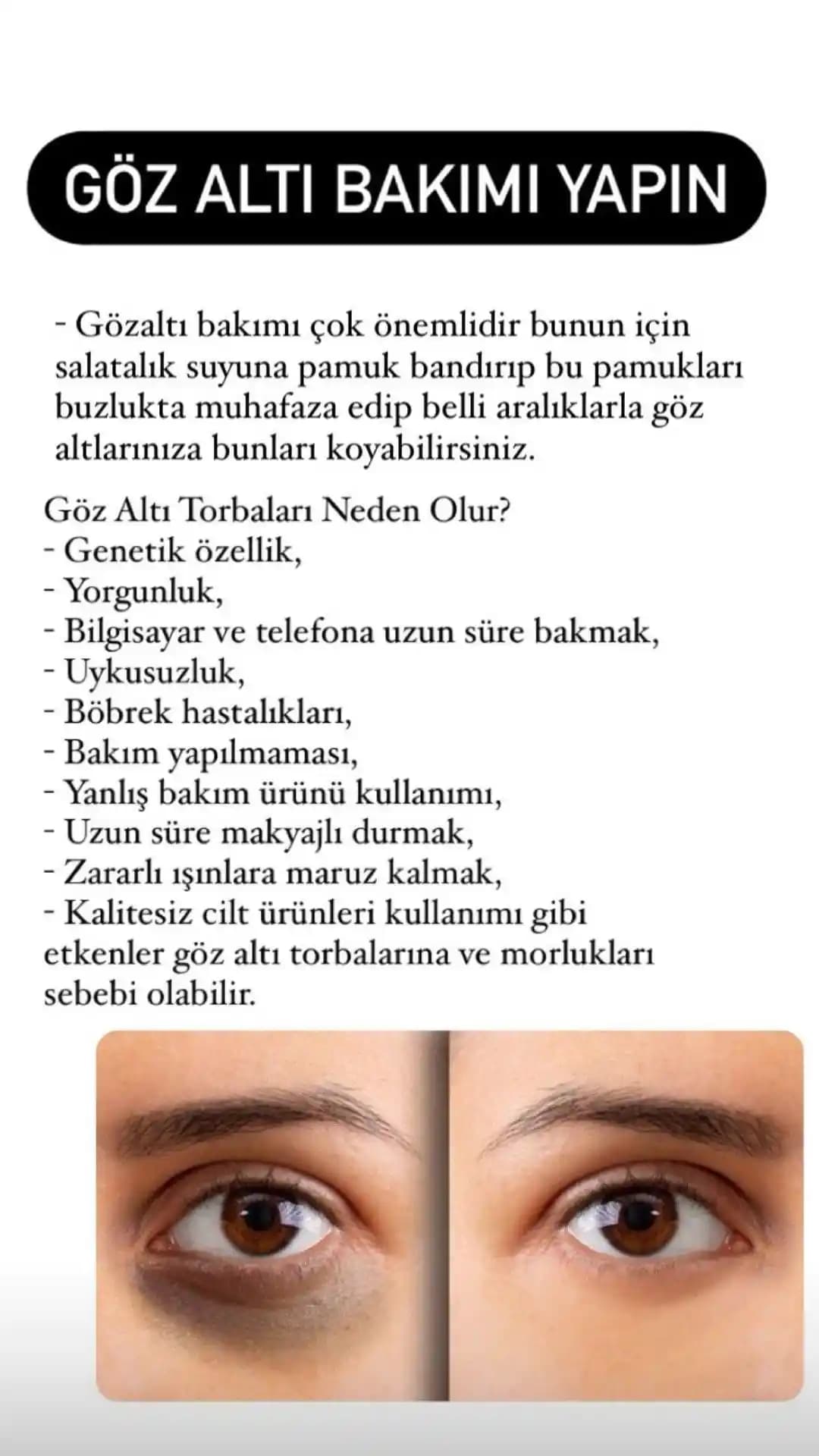 Göz Altı Gözenekleri Nasıl Geçer Güncel ve Klinik Yöntemlerle Cilt Bakımı