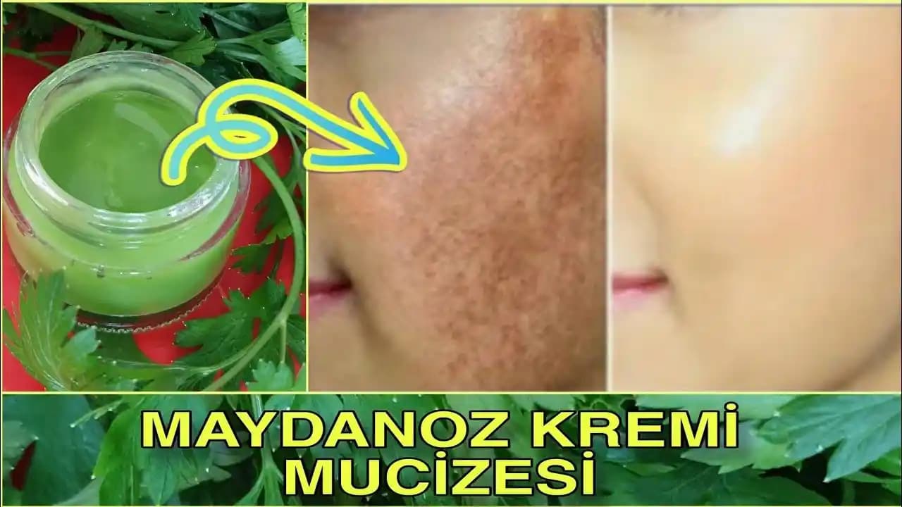 Göz Altı Güneş Lekeleri: Nedenleri, Tedavi Yöntemleri ve Doğal Çözümler