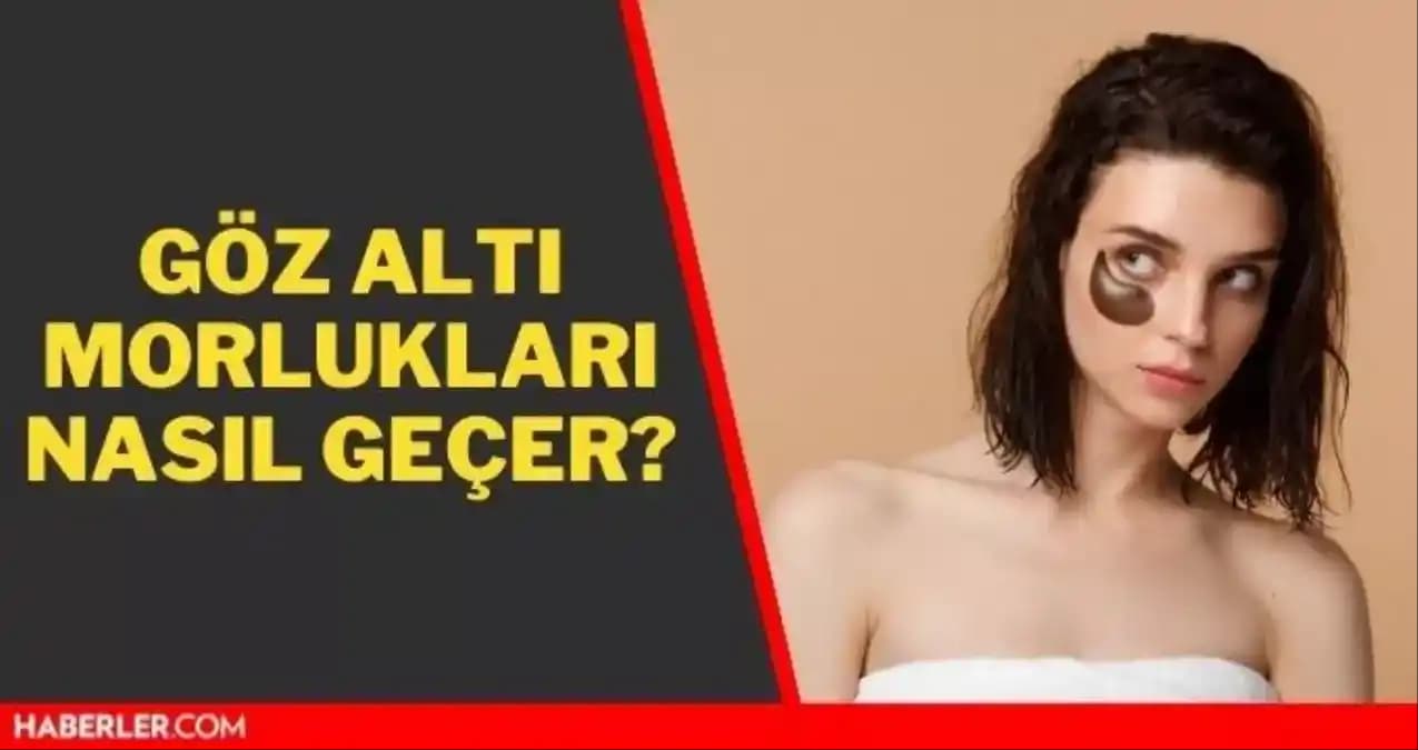 Göz Altı Kararması Nedenleri ve Etkili Çözüm Yöntemleri Hakkında Bilgiler